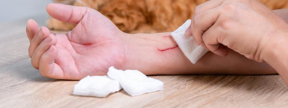 Person tending to a scratch on their arm with gauze, while a ginger cat sits nearby