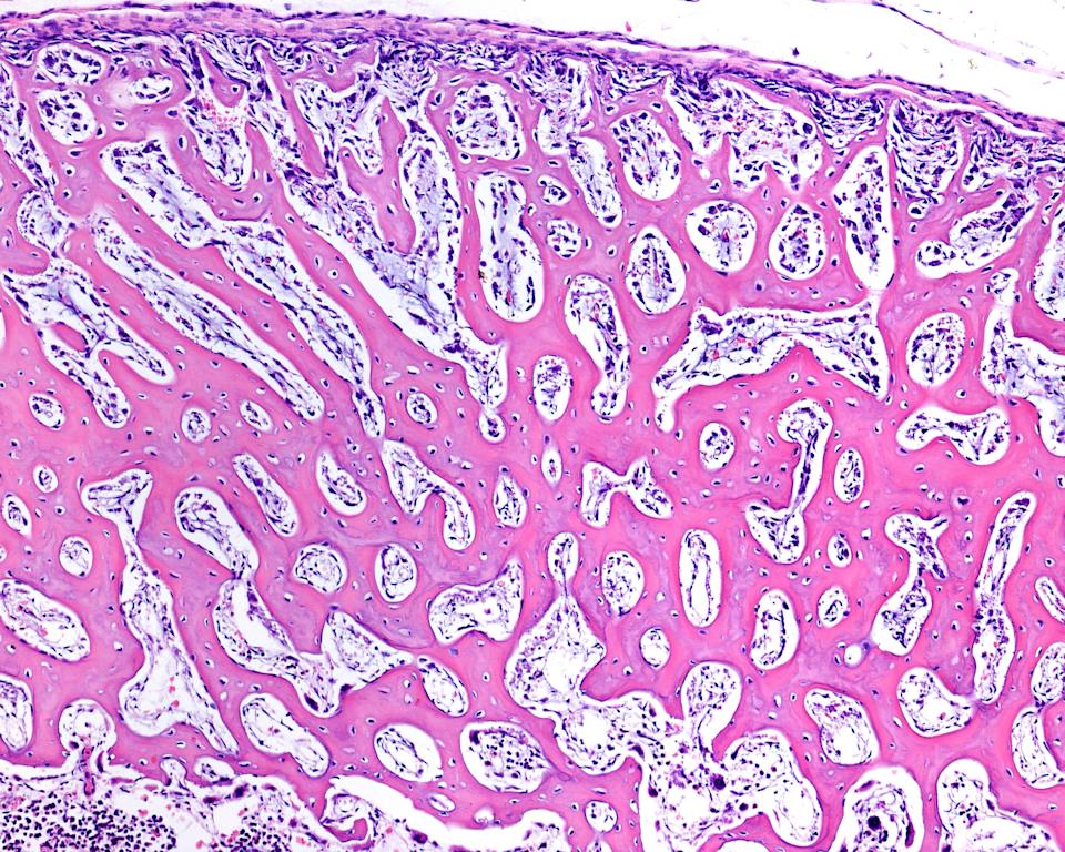Microscopic view of bone tissue showing intricate patterns of bone cells and matrix