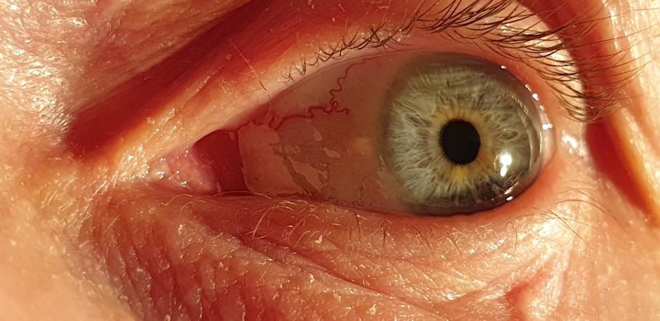 Close-up of a person's eye, showing detailed texture and intricate patterns on the iris and sclera